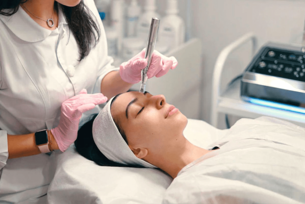 microneedling